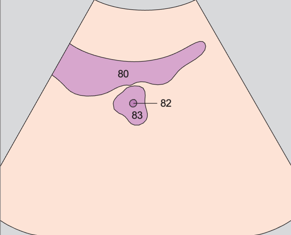 Bladder anatomy diagram, Prostate, urethra, bladder