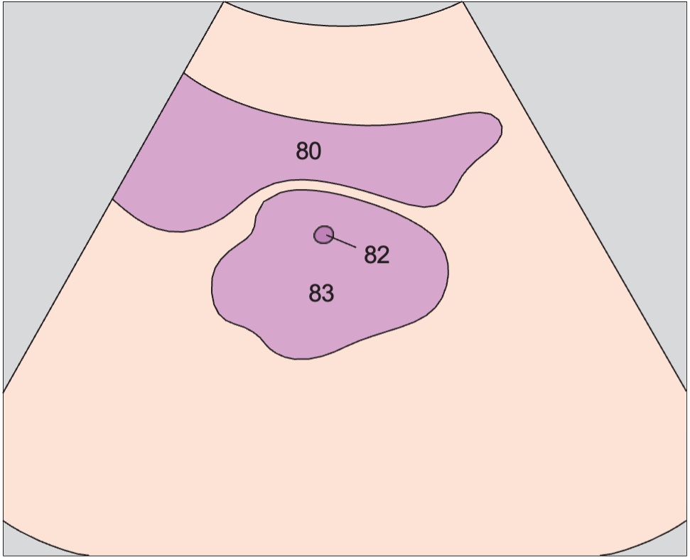 Bladder anatomy diagram, Prostate, urethra, bladder