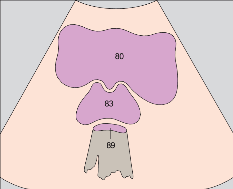 Bladder anatomy diagram, Prostate, bladder