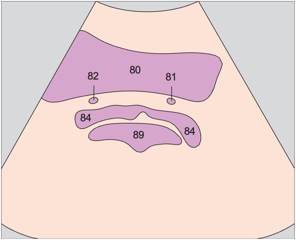 Bladder anatomy diagram, Seminal vesicles, bladder