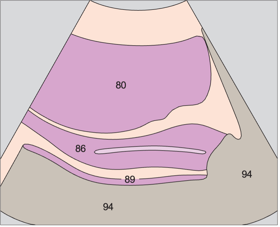 Bladder anatomy diagram, Vagina, bladder