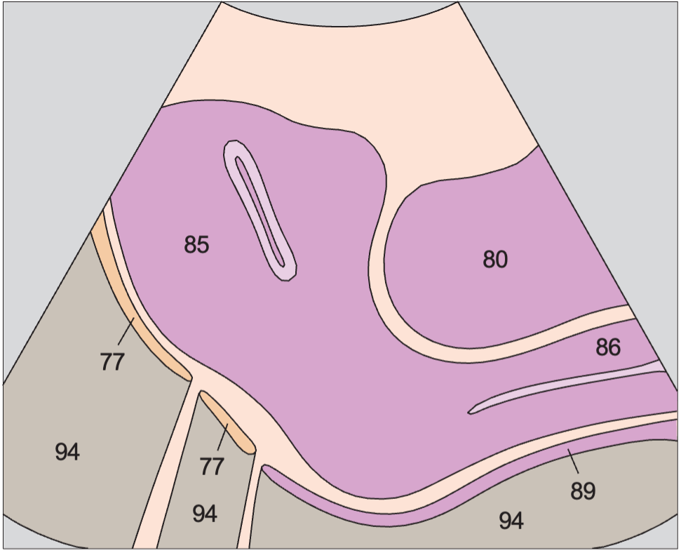 Bladder anatomy diagram, Vagina, uterus, bladder