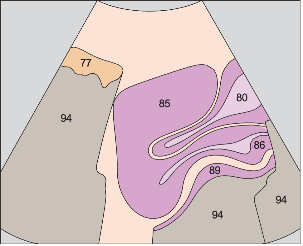Bladder anatomy diagram, Vagina, uterus, bladder