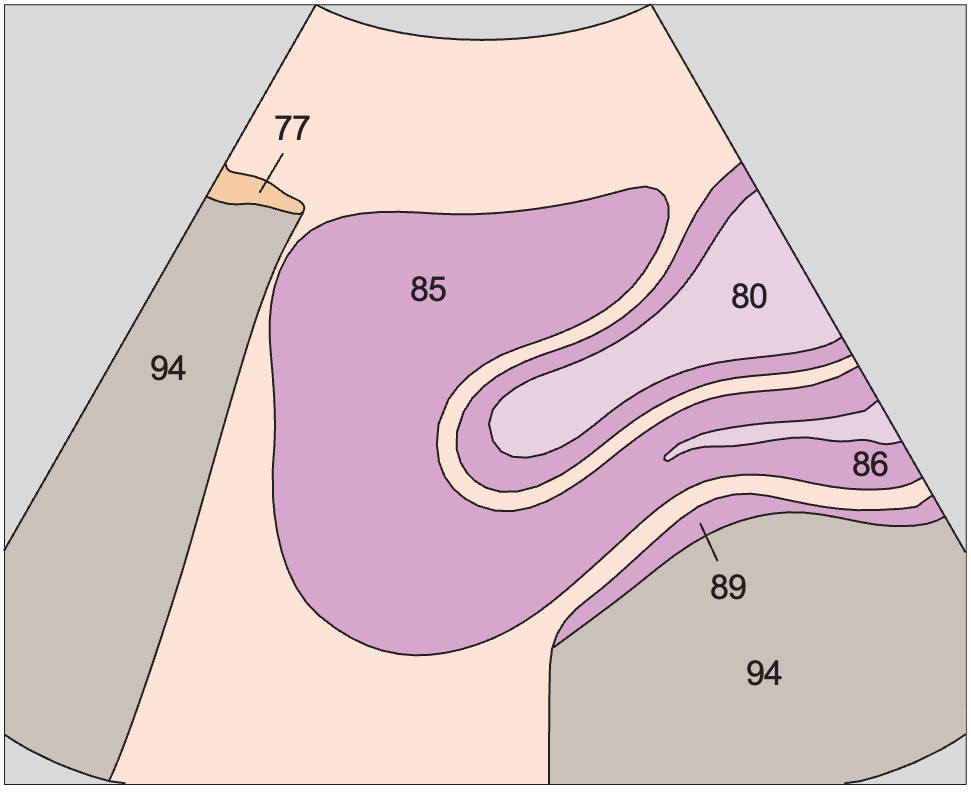 Bladder anatomy diagram, Uterus, bladder
