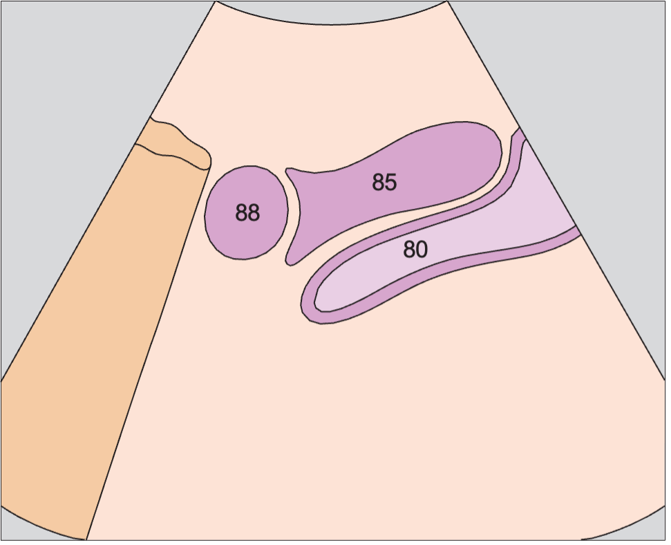 Bladder anatomy diagram, Uterus, ovary, bladder