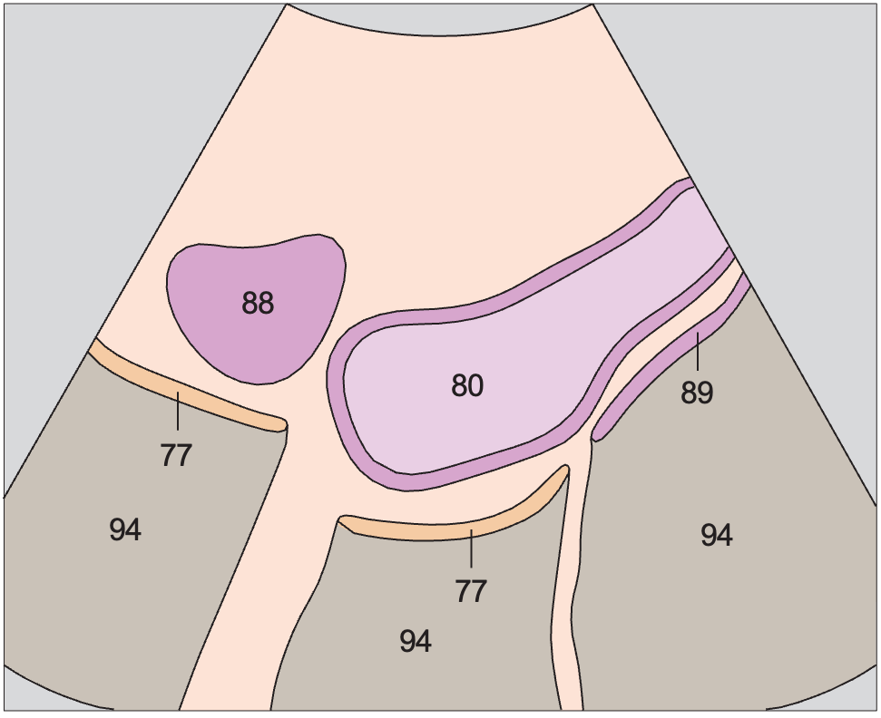 Bladder anatomy diagram, Bladder, ovary