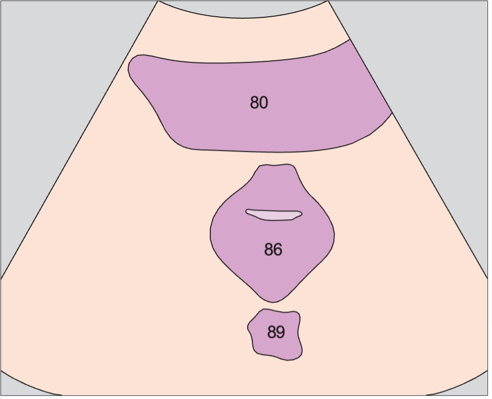 Bladder anatomy diagram, Vagina, bladder, rectum