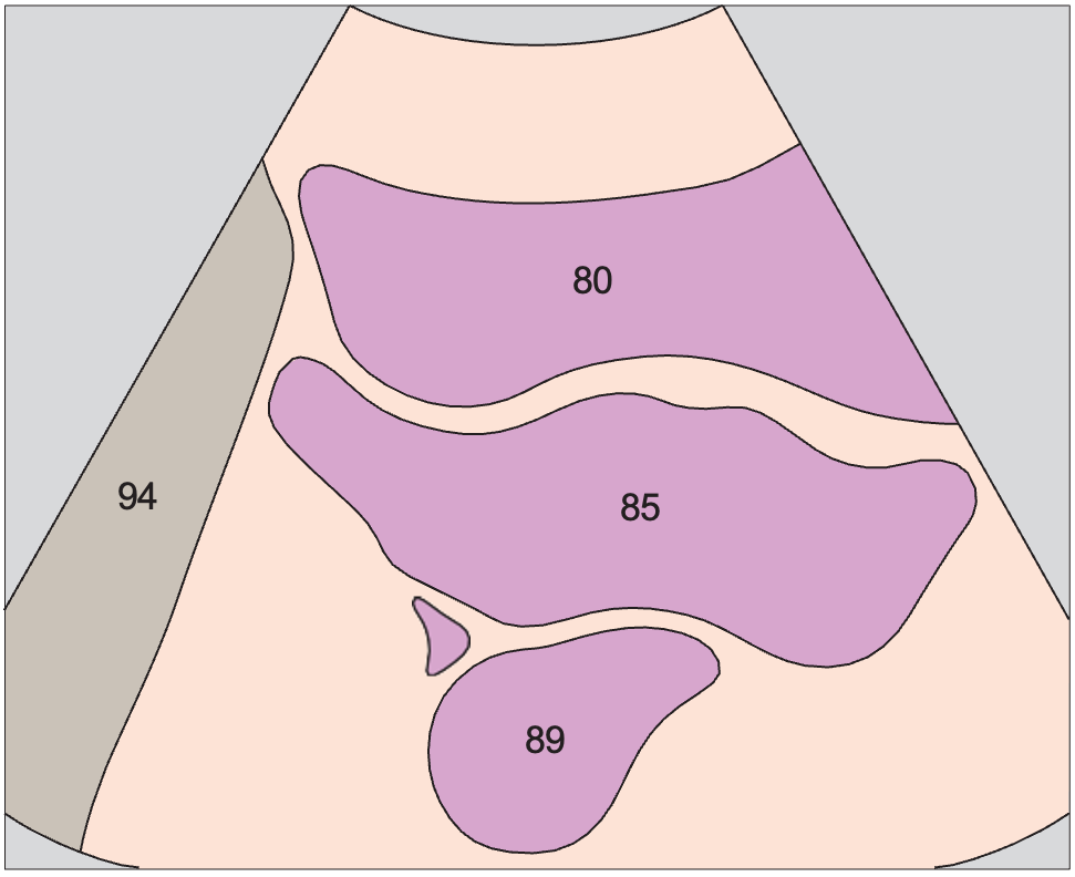 Bladder anatomy diagram, Uterus, bladder, rectum