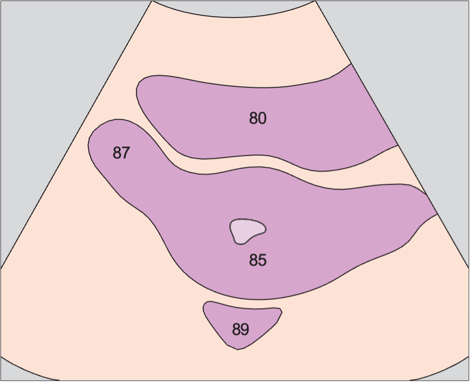 Bladder anatomy diagram, Uterus, bladder, rectum, ovary