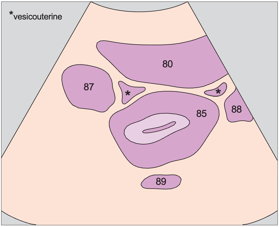 Bladder anatomy diagram, Uterus, bladder, rectum, ovaries