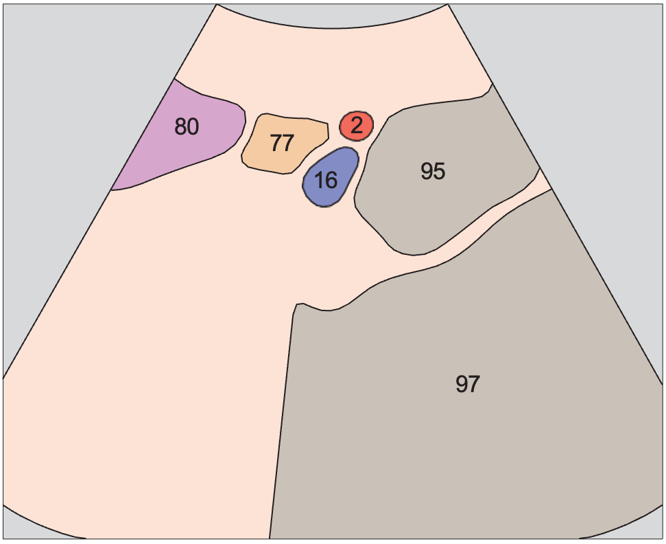 Bladder anatomy diagram, Left iliac vessels