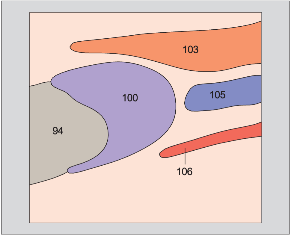 Artifact anatomy diagram, Left lobe of thyroid gland, sternocleidomastoid muscle, common carotid artery, internal jugular vein