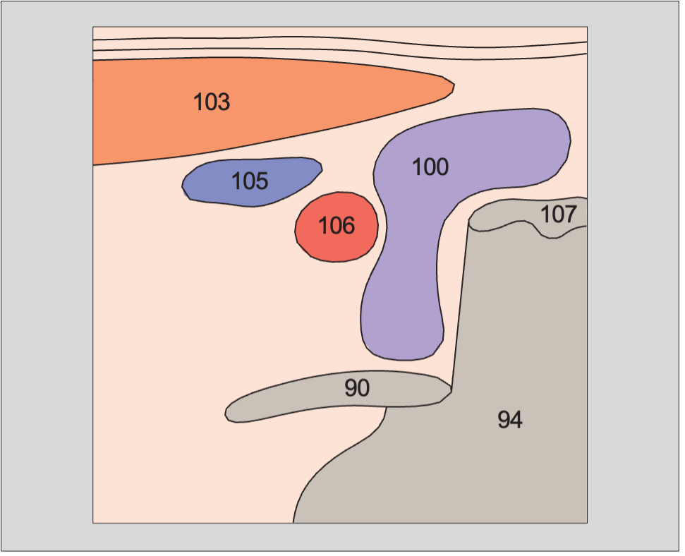 Artifact anatomy diagram, Right lobe of thyroid gland, sternocleidomastoid muscle, common carotid artery, internal jugular vein