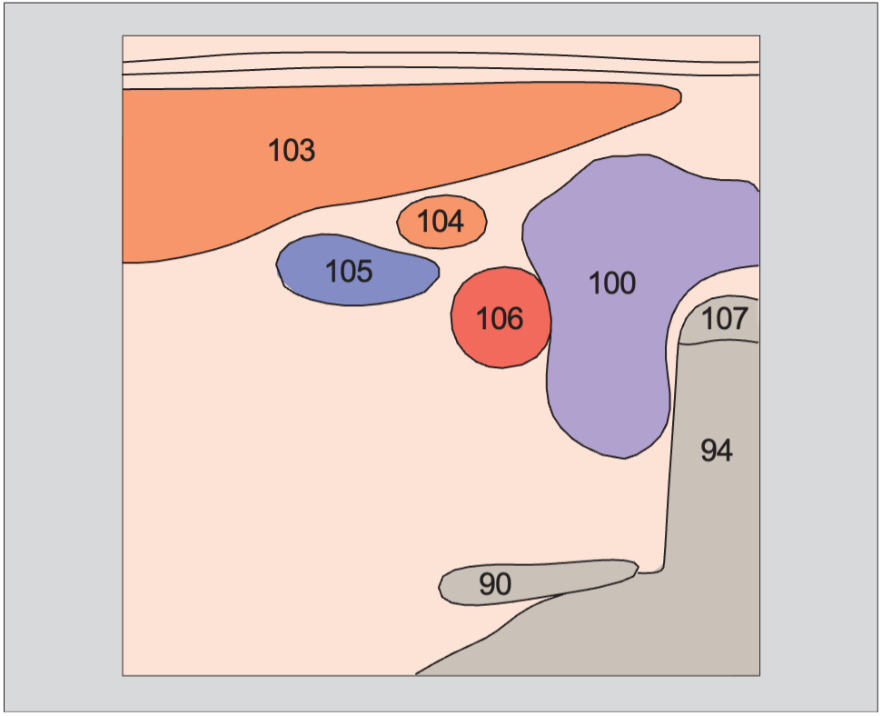 Omohyoid muscle anatomy diagram, Left lobe of thyroid gland, sternocleidomastoid muscle, omohyoid muscle, common carotid artery, internal jugular vein