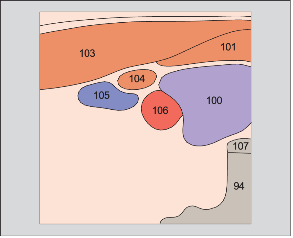 Omohyoid muscle anatomy diagram, Right lobe of thyroid gland, sternocleidomastoid muscle, omohyoid muscle, sternohyoid muscle, common carotid artery, internal jugular vein
