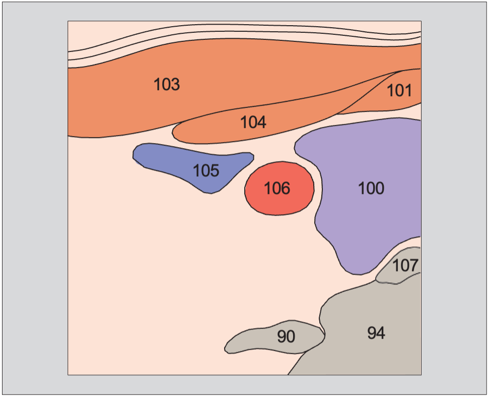 Omohyoid muscle anatomy diagram, Right lobe of thyroid gland, sternocleidomastoid muscle, omohyoid muscle, sternohyoid muscle, common carotid artery, internal jugular vein