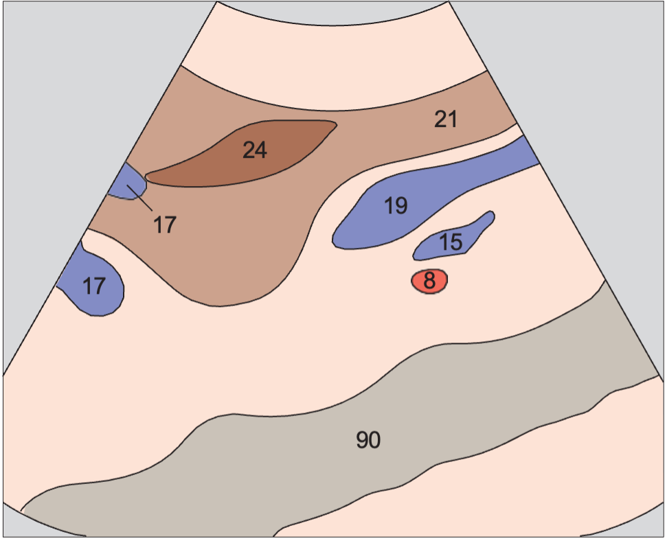 Left renal vein anatomy diagram, Right renal artery and left renal vein