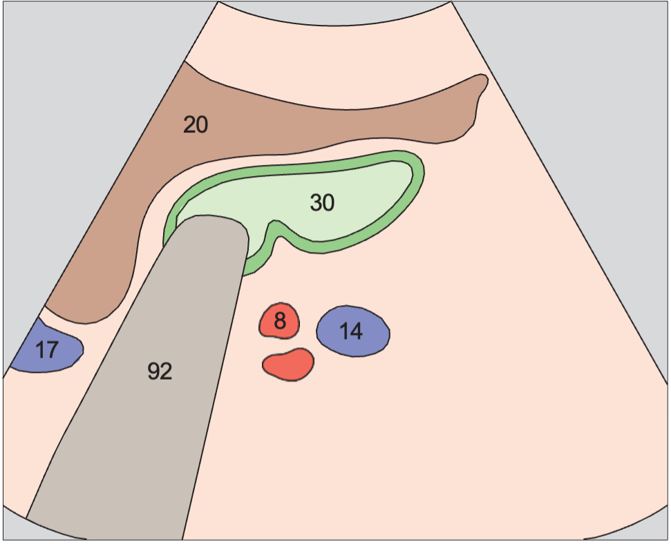 Gallbladder anatomy diagram, Right renal artery and right renal vein