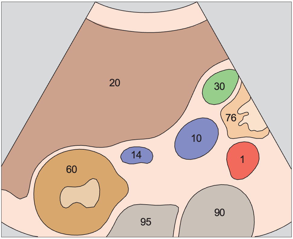 Duodenum anatomy diagram, Renal vein