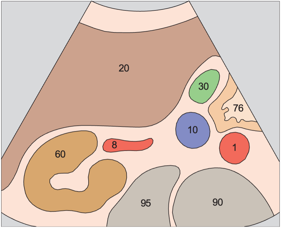 Duodenum anatomy diagram, Renal artery