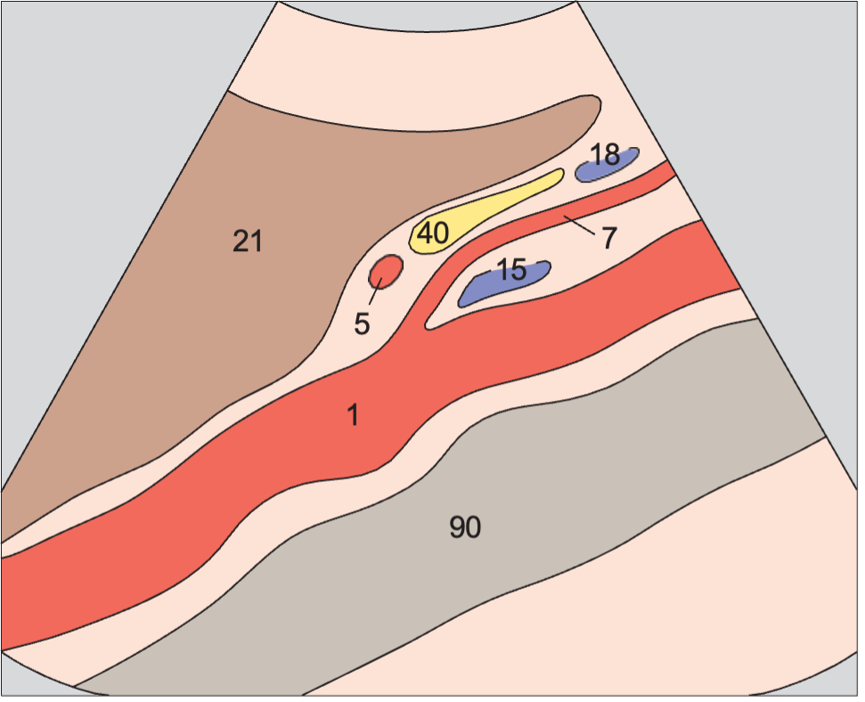 Left renal vein anatomy diagram, Aorta and left renal vein