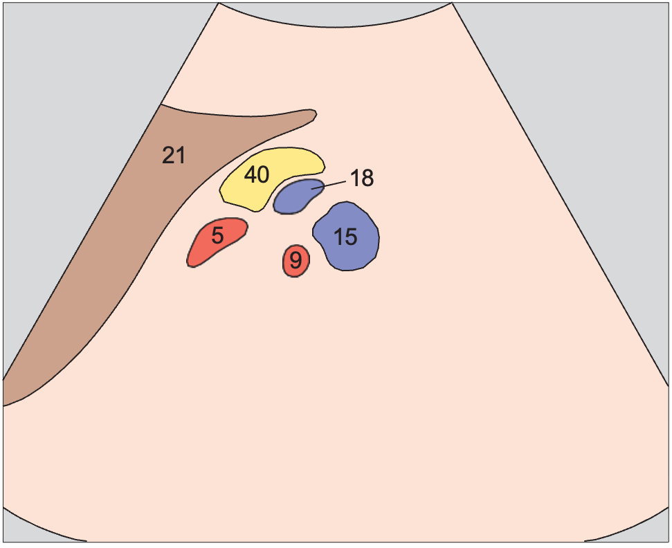 Left renal artery anatomy diagram, Left renal vessels, splenic artery and vein