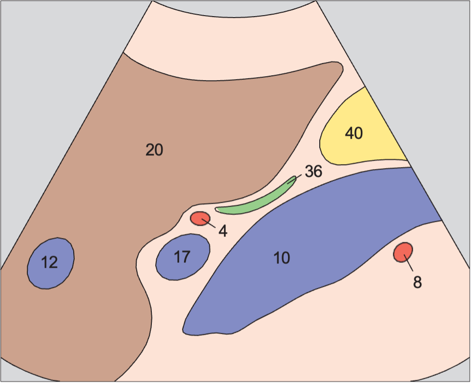 Middle hepatic vein anatomy diagram, Portal vein, vena cava, right renal artery