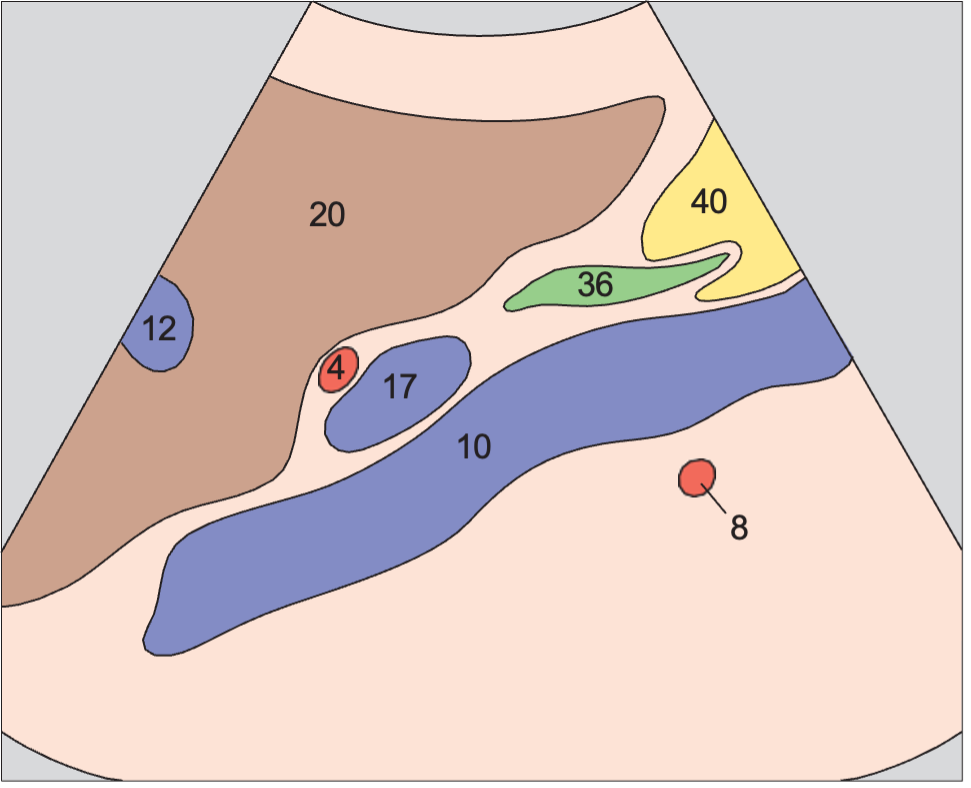 Middle hepatic vein anatomy diagram, Portal vein, vena cava, and bile duct