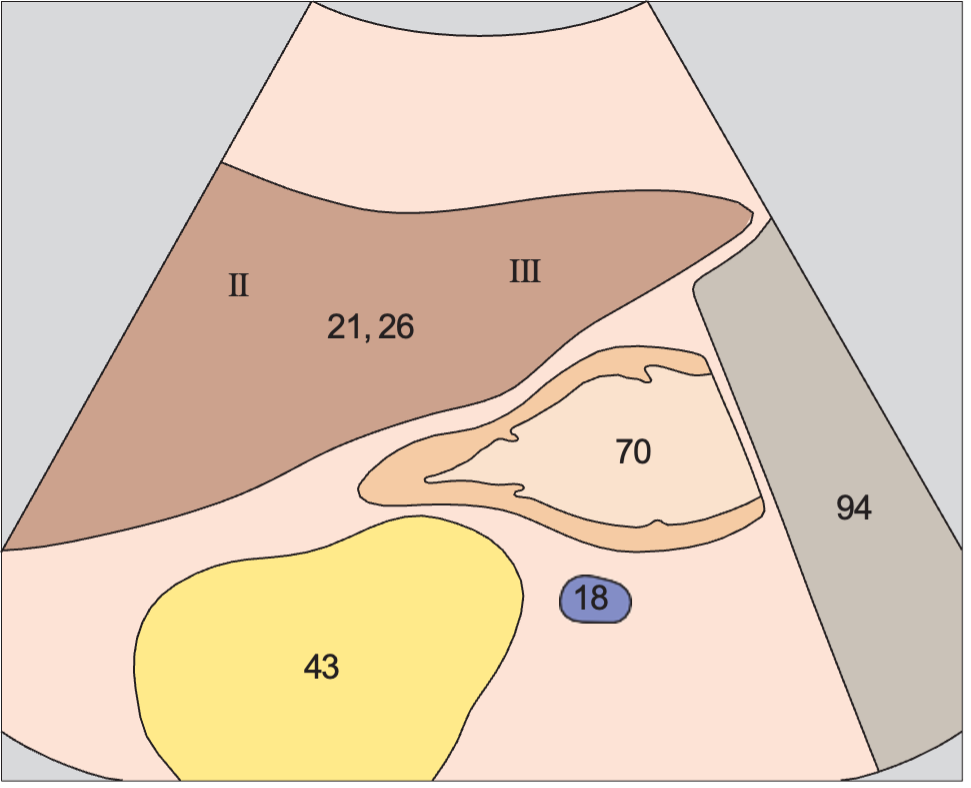 Lateral segment anatomy diagram, Left lobe of liver, lateral segment, subsegments II and III