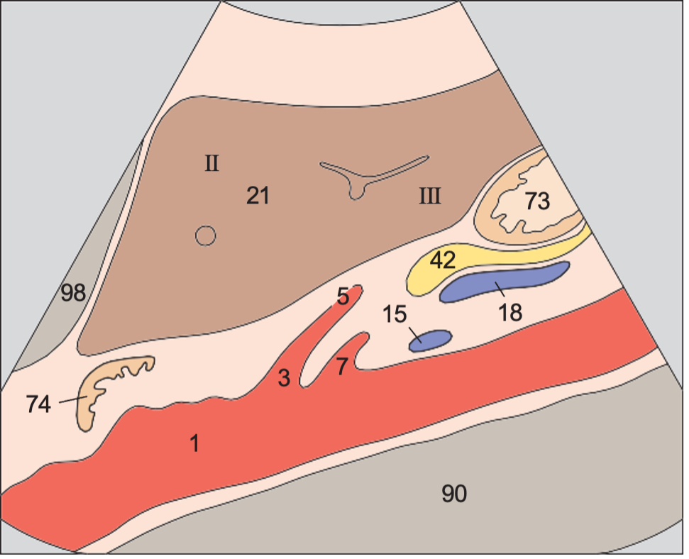 Left renal vein anatomy diagram, Left lobe of liver, ligamentum teres, boundary between lateral and medial segments