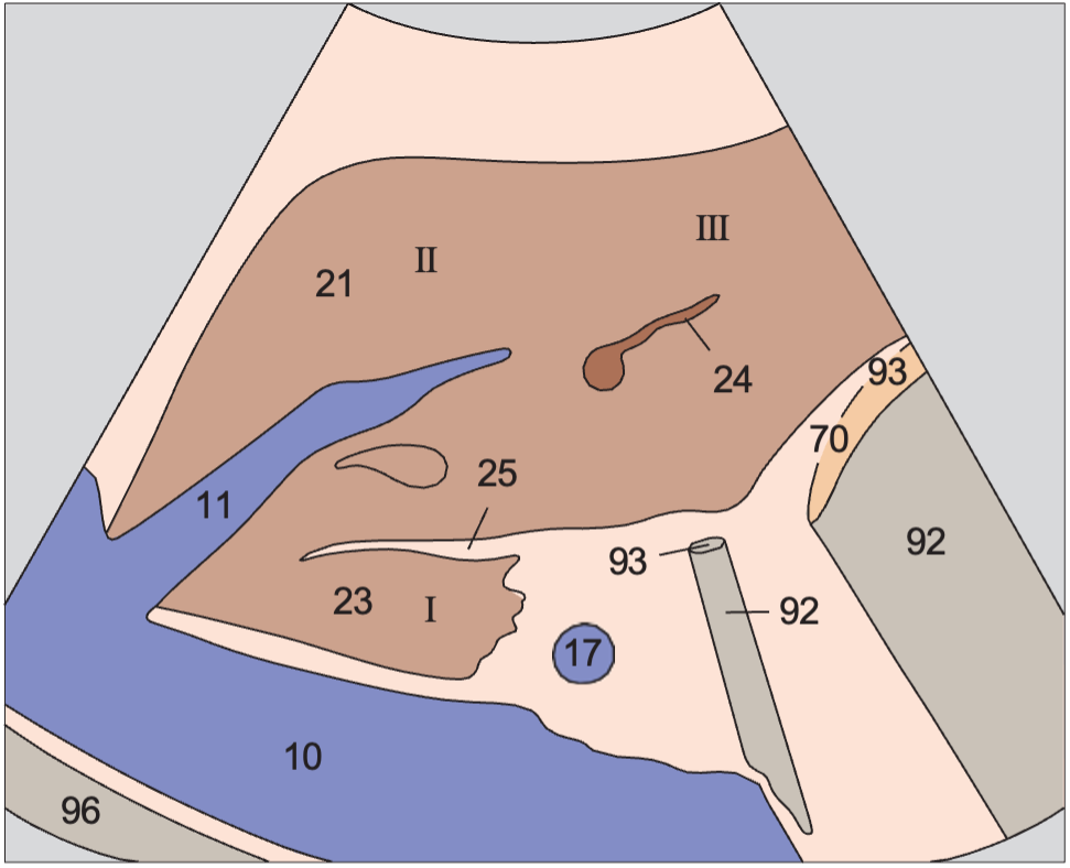 Gas anatomy diagram, Left lobe of liver, ligamentum teres, boundary between lateral and medial segments, caudate lobe