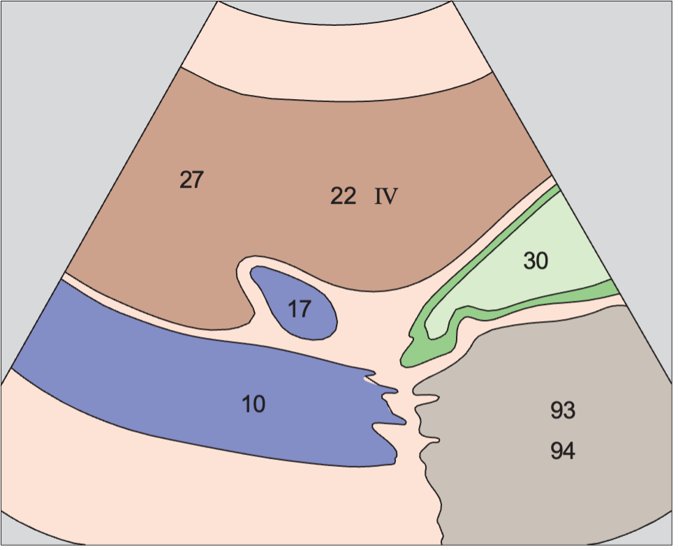 Middle hepatic vein anatomy diagram, Gallbladder, portal vein, vena cava, boundary between medial and anterior segments