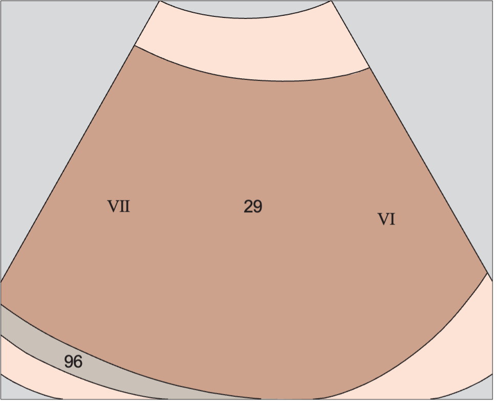 Posterior segment anatomy diagram, Posterior segment, subsegments VII and VI