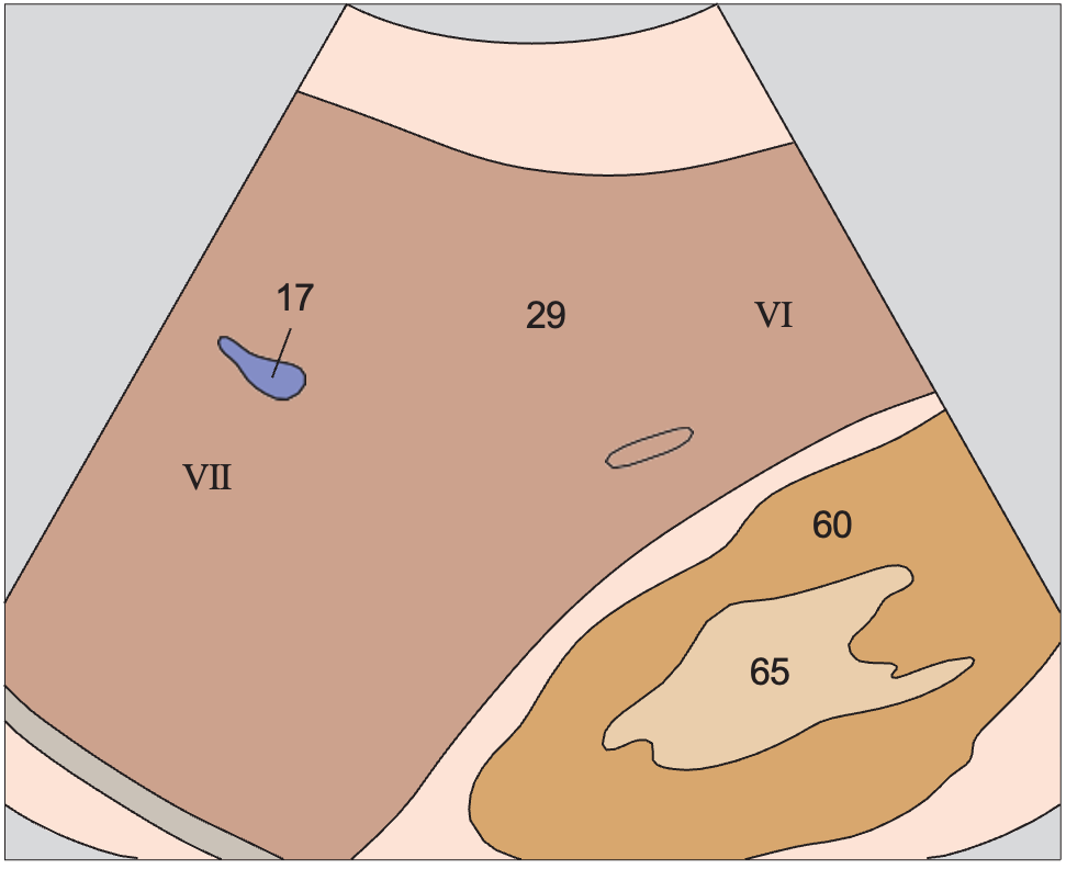 Lateral segment anatomy diagram, Posterior segment, lateral portions of liver, kidney