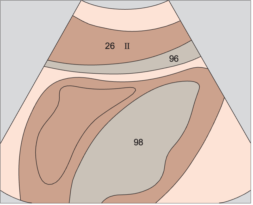 Lateral segment anatomy diagram, Left lobe of liver, lateral segment, heart
