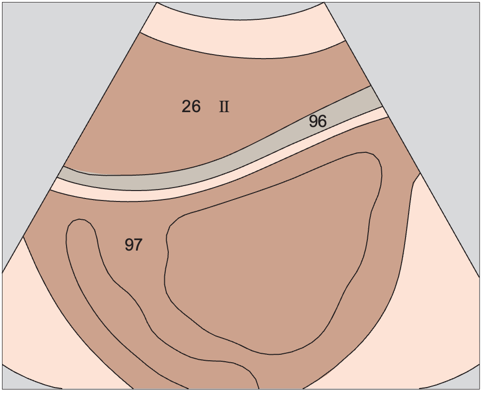 Lateral segment anatomy diagram, Left lobe of liver, lateral segment, heart
