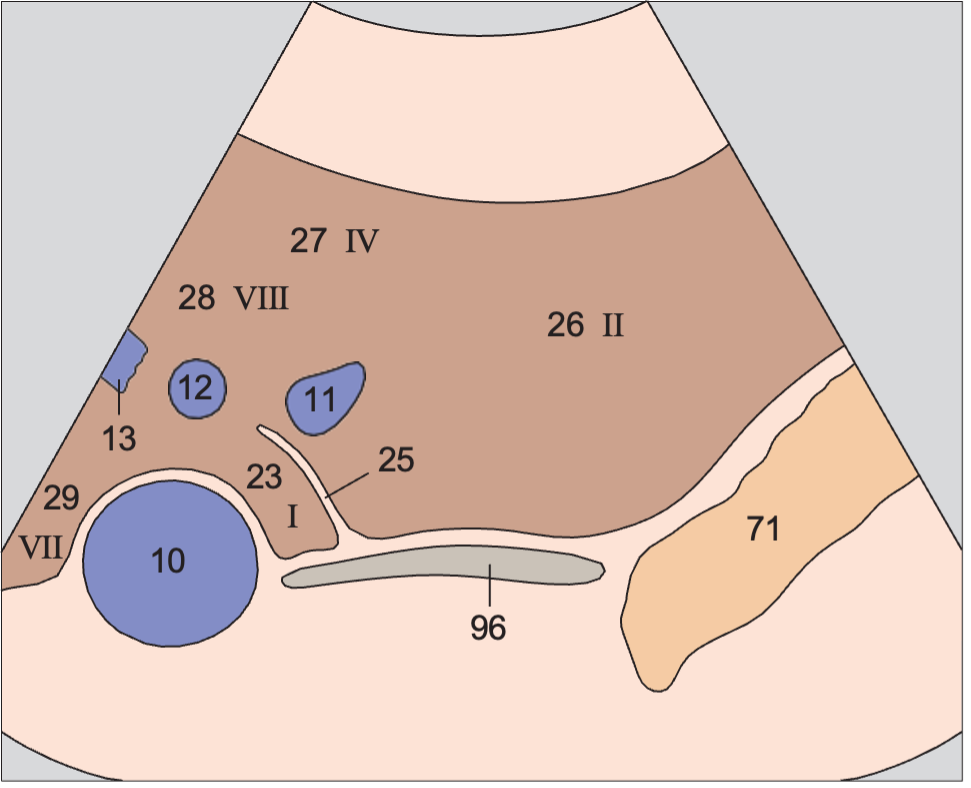 Lateral segment anatomy diagram, Left lobe of liver, lateral segment, hepatic veins