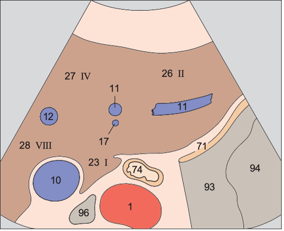 Lateral segment anatomy diagram, Left lobe of liver, lateral segment, caudate lobe