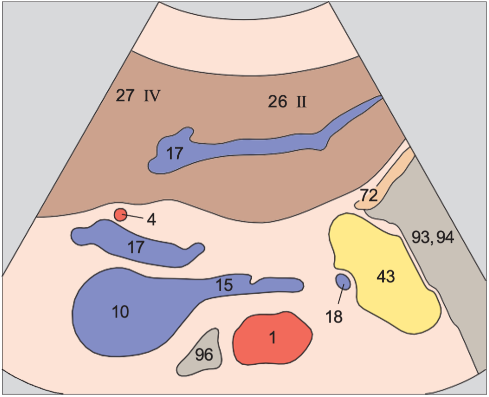 Lateral segment anatomy diagram, Left lobe of liver, lateral segment, left portal vein branch