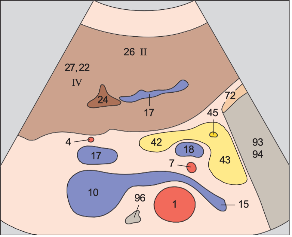 Lateral segment anatomy diagram, Left lobe of liver, lateral segment, ligamentum teres