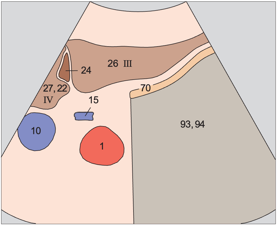 Lateral segment anatomy diagram, Left lobe of liver, subsegment III, ligamentum teres