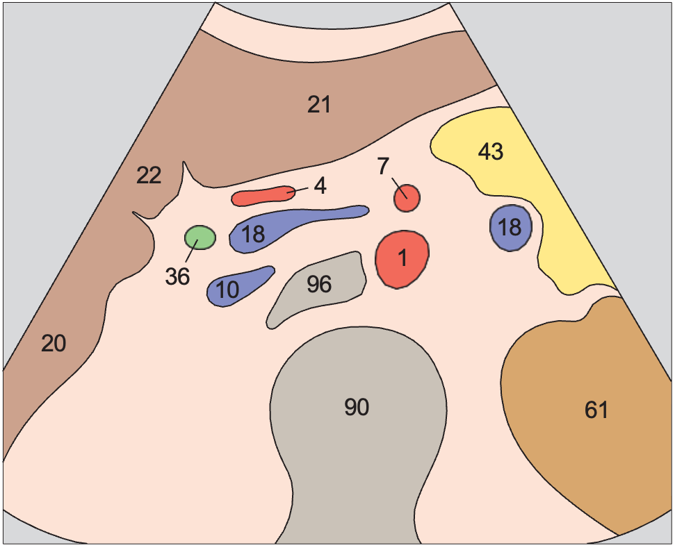 Quadrate lobe anatomy diagram, Superior mesenteric artery