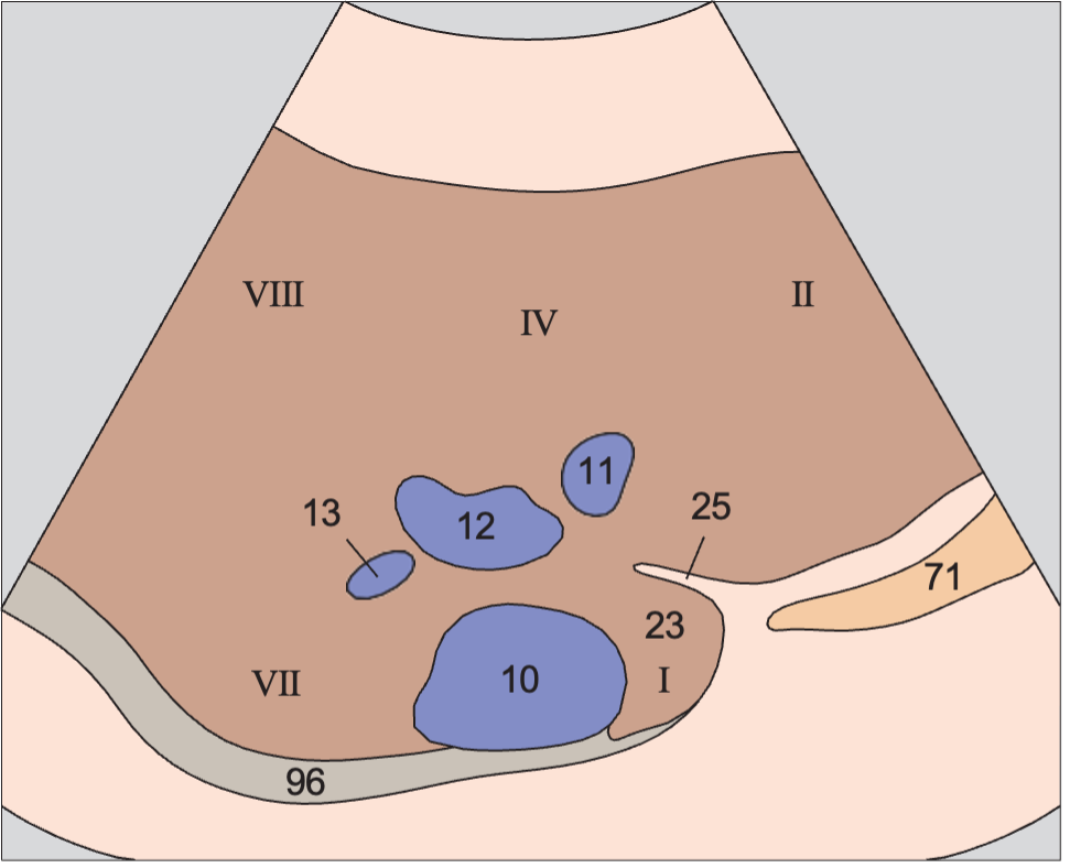 Caudate lobe anatomy diagram, Medial and anterior hepatic segments, hepatic veins, caudate lobe
