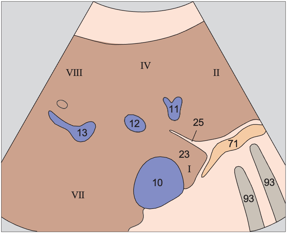 Gas anatomy diagram, Medial and anterior hepatic segments, hepatic veins, caudate lobe