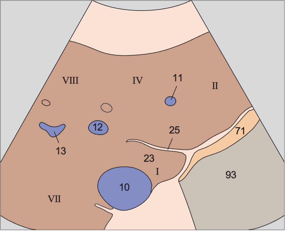 Gas anatomy diagram, Medial and anterior hepatic segments, caudate lobe