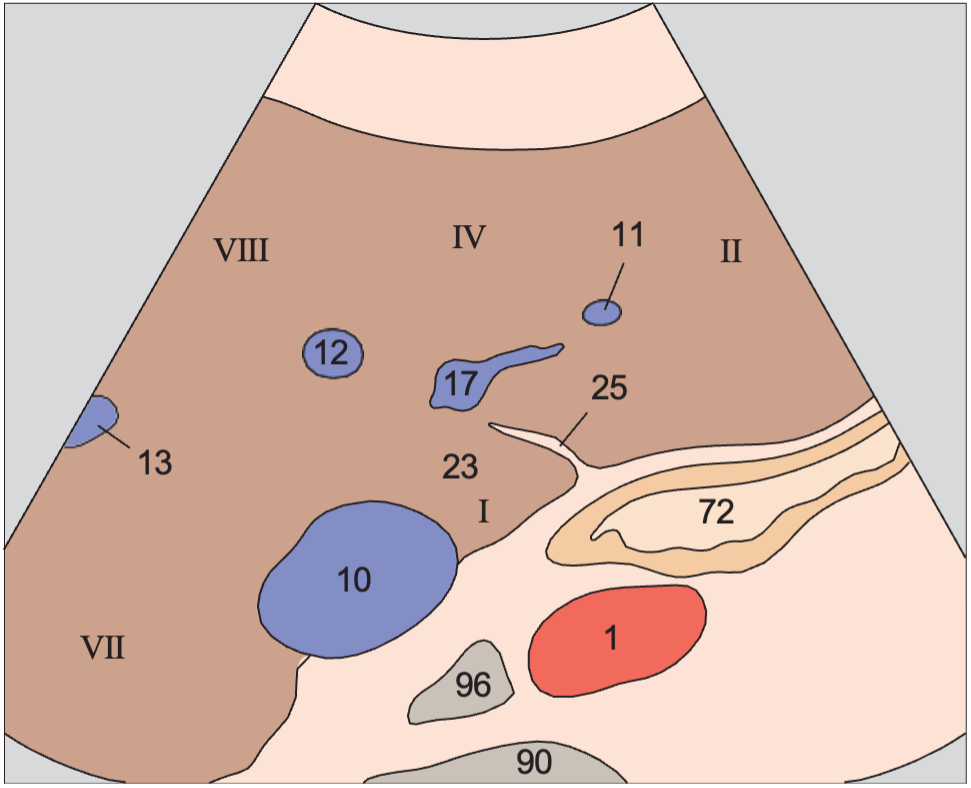 Caudate lobe anatomy diagram, Medial and anterior hepatic segments, left portal vein branch, caudate lobe