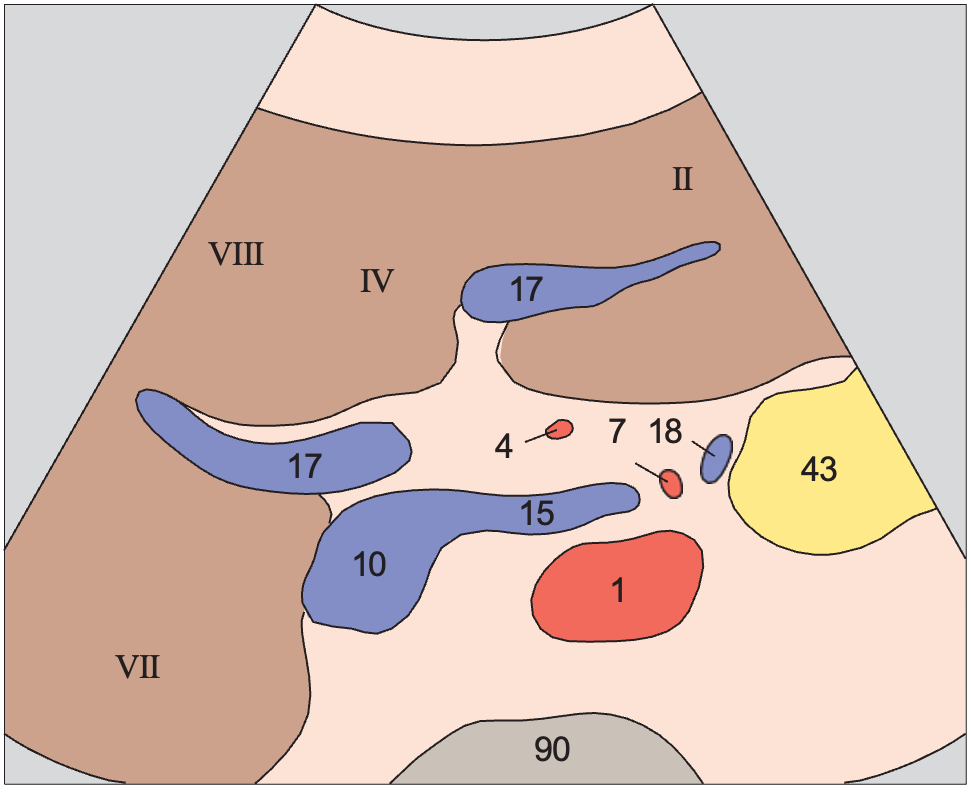Left renal vein anatomy diagram, Medial and anterior hepatic segments, right and left portal vein branches