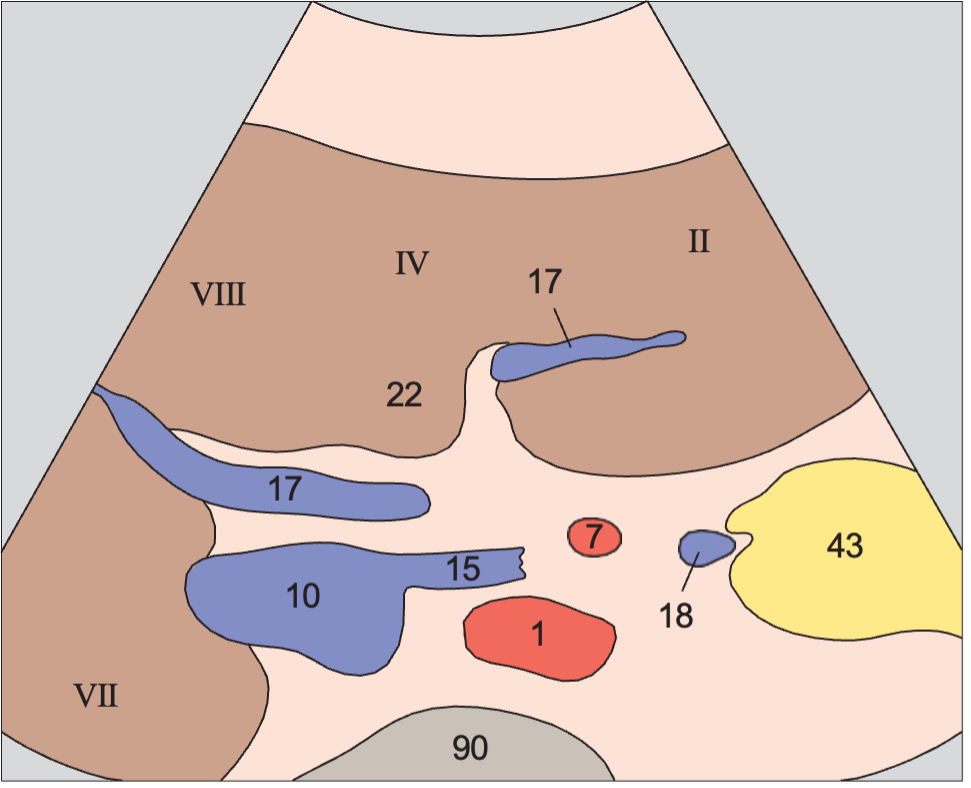 Quadrate lobe anatomy diagram, Medial and anterior hepatic segments, right and left portal vein branches