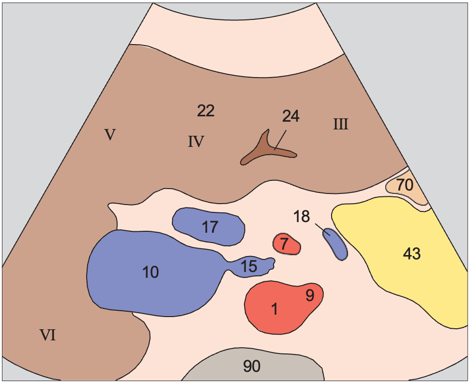 Quadrate lobe anatomy diagram, Medial and anterior hepatic segments, quadrate lobe, ligamentum teres, portal vein