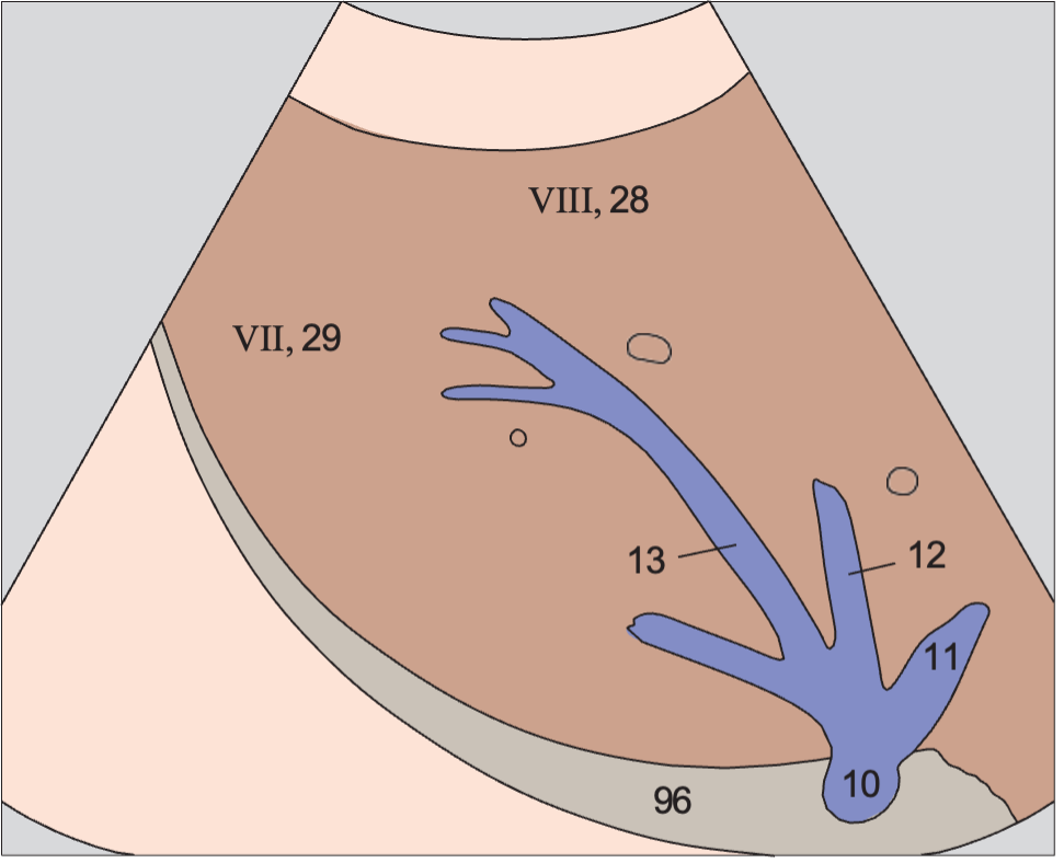 Posterior segment anatomy diagram, Posterior segment, cranial subsegment